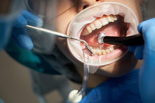 Lady patient sitting in stomatology chair, dentist drilling tooth, modern clinic