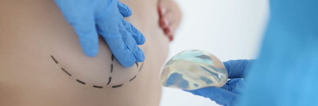 Girl tries on new breast with help of silicone three dimensional form. Special marking is made on girl chest before complex plastic surgery for reast augmentation