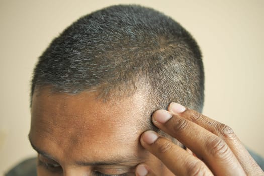 hair loss concept with man checking his hair .