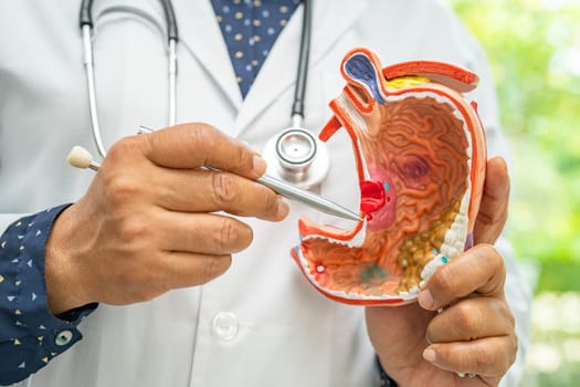 Stomach disease, doctor holding anatomy model for study diagnosis and treatment in hospital.