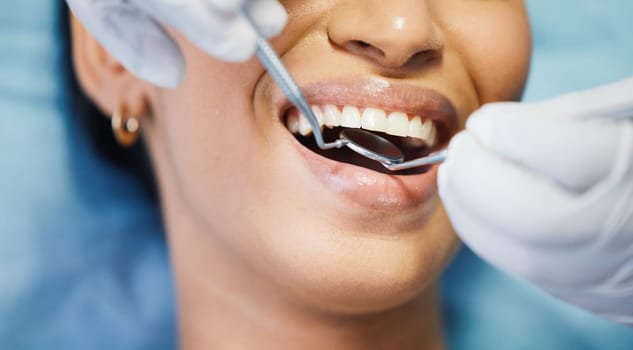 Dentist, mirror and hands, patient mouth and medical tools, surgery and dental health. Tooth decay, healthcare and people at orthodontics clinic for oral care, metal instrument and gingivitis.