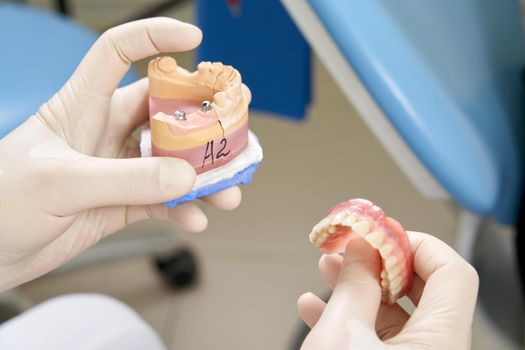 Male dentist showing his female patient a dental implant in modern clinic