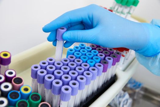 Scientist working with blood sample in laboratory. High quality photo