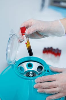 The blood in the test tube is placed in a centrifuge for plasma therapy. Modern medical equipment.