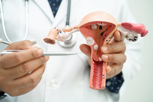 Uterus, doctor holding anatomy model for study diagnosis and treatment in hospital.