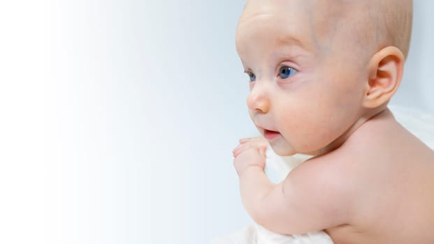 a baby with a hemangioma on his neck lies on a white background. banner with a copy space. profile of a little bald baby girl. the kid looks to the side