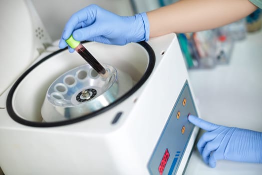 Plasmolifting. Preparation of blood for injections. cosmetologist puts tube of blood in centrifuge for separation processing.