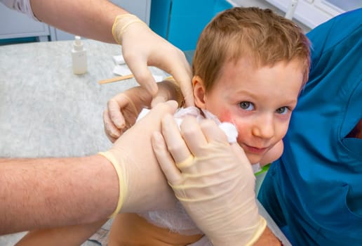 medical procedure dressing a boy with a first-degree burn from boiling water on his face, neck and chest