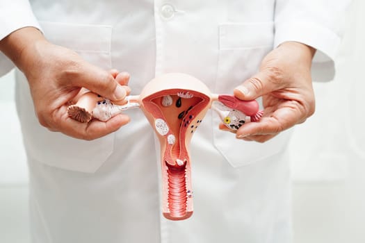 Uterus, doctor holding anatomy model for study diagnosis and treatment in hospital.