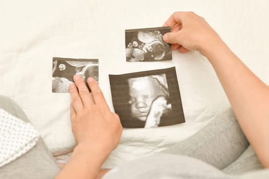 Pregnant woman holding 4D ultrasound image