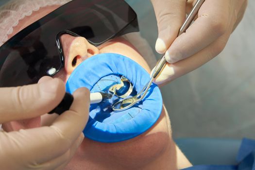 Young woman getting dental treatment at dentist office with a dental rubber dam protection