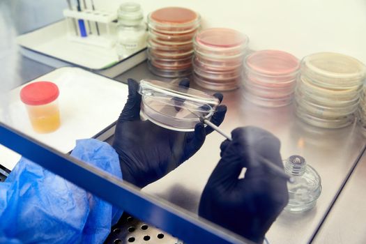 medical technologist doing urine test in medical laboratory wearing protective uniform. High quality photo