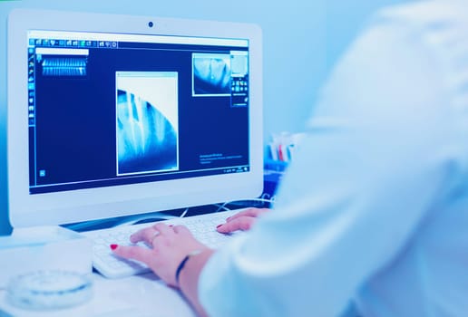 A female medical doctor looking at x-rays and using laptop in a hospital.