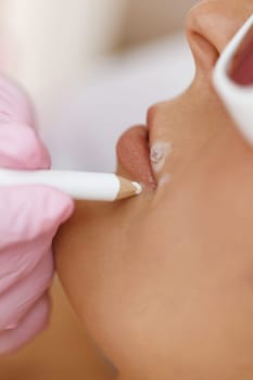 Laser hair removal specialist draws on moles on the woman's face with a protective pencil. Women's hands in gloves mark the area for epilation and protection of moles with a pencil. Laser hair removal
