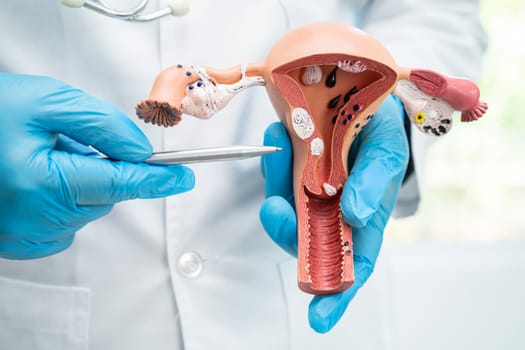 Uterus, doctor holding anatomy model for study diagnosis and treatment in hospital.