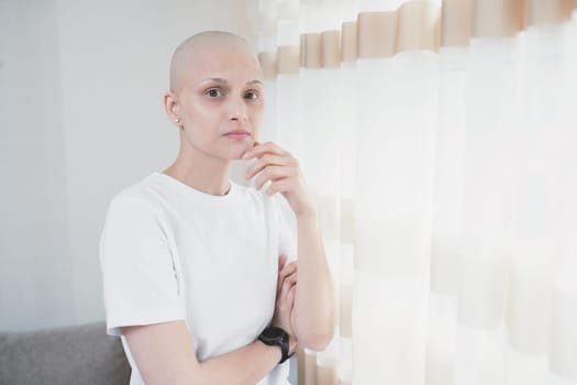 Hairless young woman with cancer wearing a white t-shirt looking at camera in room.
