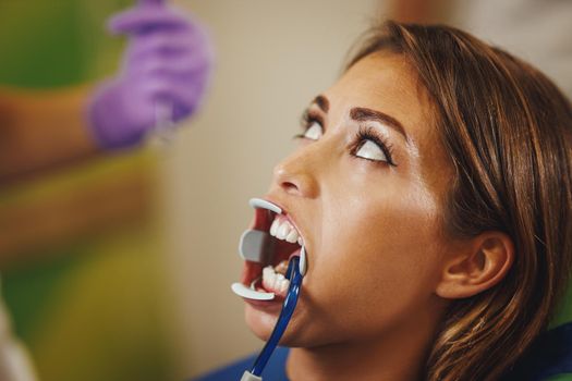 Cropped shot of a beautiful young woman is at the dentist. She sits in the dentist's chair and the dentist preparing to sets braces on her teeth putting aesthetic self-aligning lingual locks.