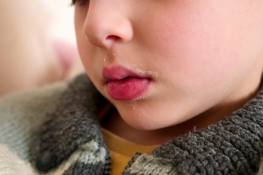 milk residues in the mouth area of a child who drinks milk,