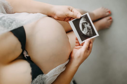 Young pregnant woman with the belly and babys ultrasound paper in the hand, pregnancy concept