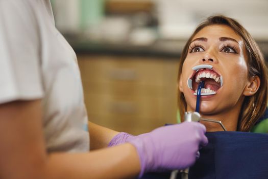 Shot of a beautiful young woman is at the dentist. She sits in the dentist's chair and the dentist preparing to sets braces on her teeth putting aesthetic self-aligning lingual locks.