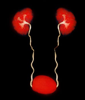 CTA Renal artery  3D rendering image  showing both kidney, Ureter and bladder .