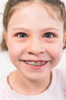 Little girl with rainbow braces smiling at the camera.