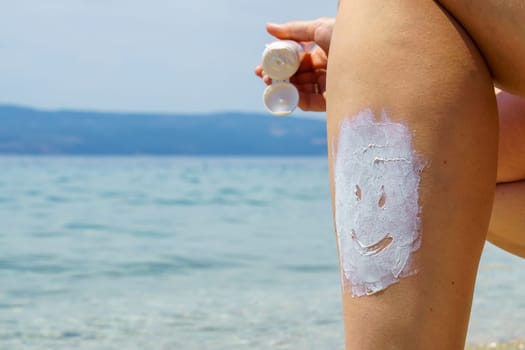 Person applying and spreading sunscreen cream to man back. Sunblock skin prevention. cream to protect the skin from UV sunlight. Solar protection.