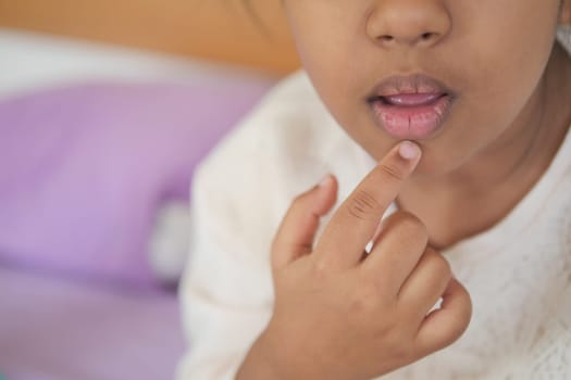 close up of dry lip of a child ,