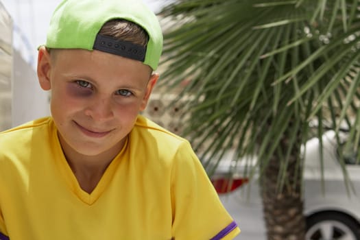 a boy with a black eye sits in the park, portrait of a boy in a cap with a black eye. High quality photo