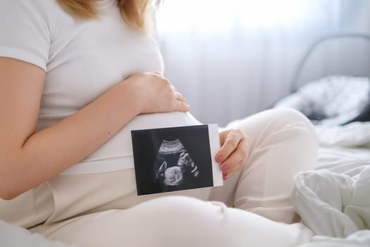 Pregnant woman holding UZ photo of baby near belly. Expecting of baby