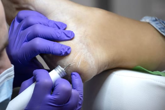 cleaning cracks on the feet in a healing studio, beauty saloon