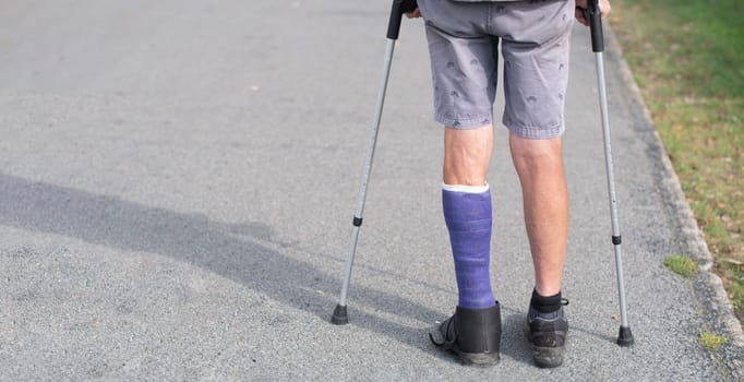 man with a broken leg walks down the street, his left leg is in a cast, the man moves with the help of crutches, walking only with his healthy leg, High quality photo