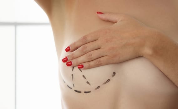 Breast correction and plastic surgery and small female breasts. Preparing for breast plastic surgery