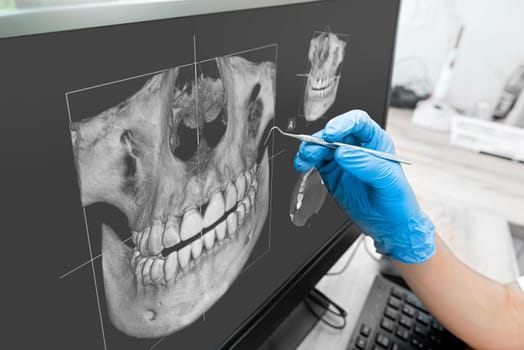 Doctor looking at human teeth x-ray on computer monitor. Modern dental clinic.