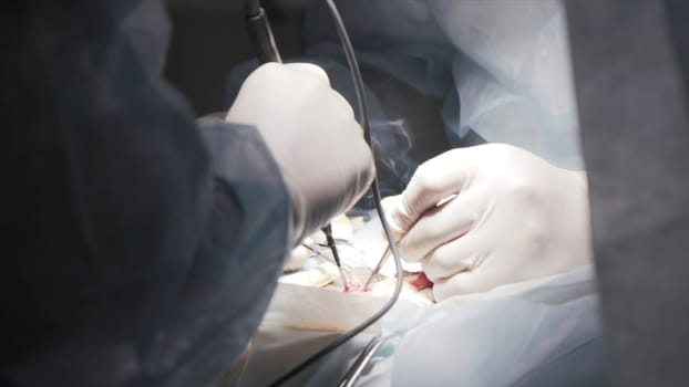 Close up of procedure is being carried out on a patient with professional equipment. Surgeons hands operating patient in the clean room, concept of health and medicine.