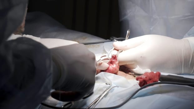 Sewing up the surgical wound with medical tools and catgut. Close up of surgeon hands stitches a wound after the surgery of the male genital system.