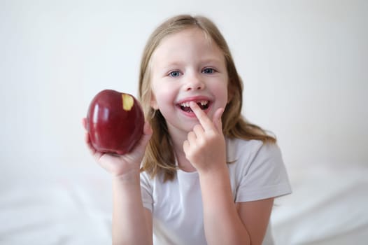 Smiling girl without tooth is holding apple. Pediatric dentistry and loss of milk teeth concept