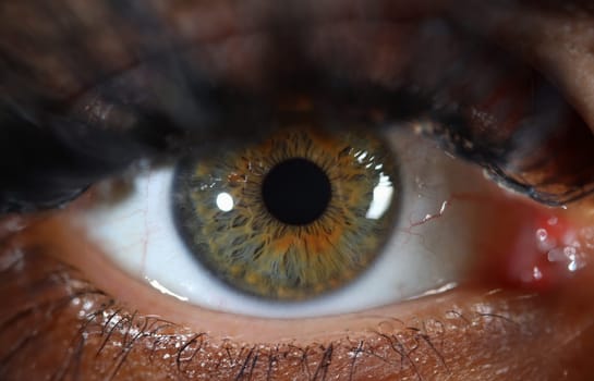 Detail of human eye with gray green iris. Eye diseases and laser vision correction concept