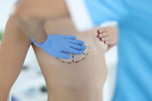 Closeup of body of naked sexy woman with black surgical marks on chest. Plastic surgery breast augmentation and lift concept