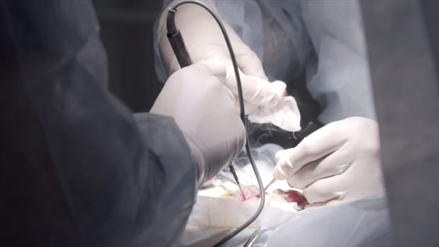 Close up of procedure is being carried out on a patient with professional equipment. Surgeons hands operating patient in the clean room, concept of health and medicine.
