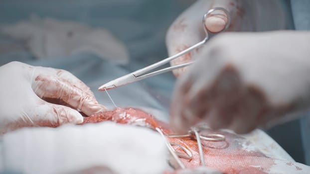 Surgeons cutting flesh. Action. Close-up of surgical intervention in male genital organ. Bloody penis enlargement surgery.