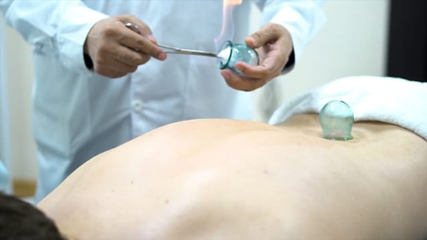 Acupuncture therapist placing a cup on the back of a male patient, ancient Chinese alternative medicine. Close up for a doctor giving cupping treatment on young man back