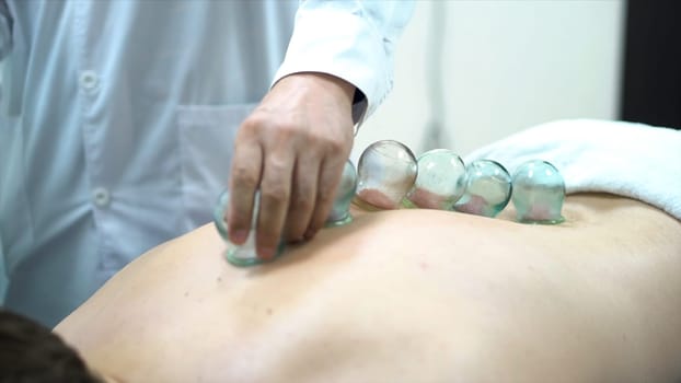 Acupuncture therapist placing a cup on the back of a male patient, ancient Chinese alternative medicine. Close up for a doctor giving cupping treatment on young man back