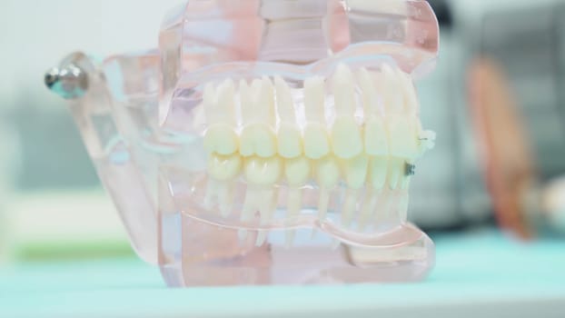Close-up of denture jaw. Media. Denture of jaws with teeth with transparent gums stands on table in dental office. Modern design of jaw prosthesis.