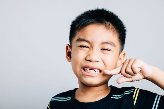 Child an Asian boy highlights dental care by pointing to missing front tooth. White background emphasizes gap and signifies process of tooth exfoliation. Children show teeth new gap, dentist problems