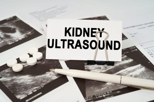 Medical concept. On the ultrasound pictures there is a pen and a business card with the inscription - Kidney ultrasound