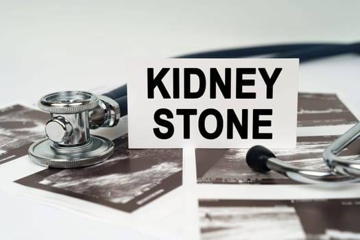 Medical concept. On the ultrasound pictures there is a stethoscope and a business card with the inscription - Kidney stone
