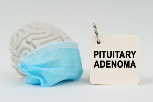 Medical concept. On a white surface there is a brain with a blue mask and a notepad with the inscription - Pituitary adenoma
