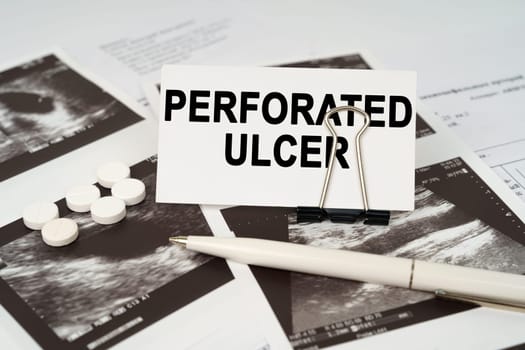 Medical concept. On the ultrasound pictures there is a pen and a business card with the inscription - Perforated ulcer
