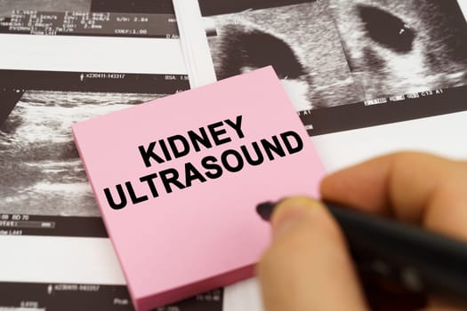 Medical concept. On the ultrasound pictures there are stickers that say - Kidney ultrasound